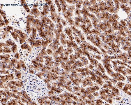 HUABIO ET7110-58 image 2