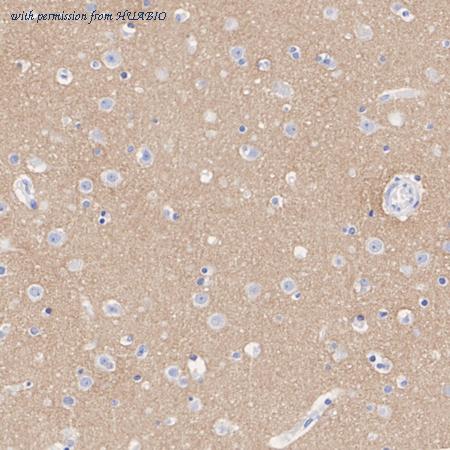 HUABIO ET7110-59 image 1