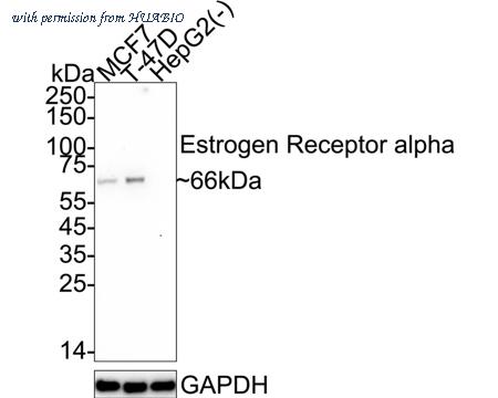 HUABIO ET7110-60 image 1