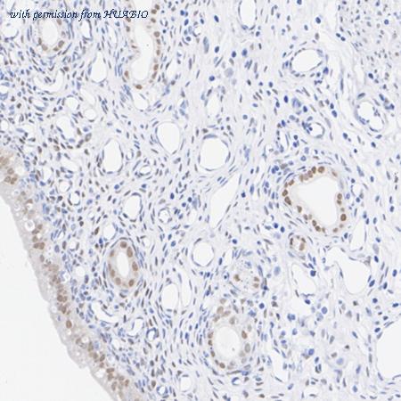 HUABIO ET7110-60 image 2