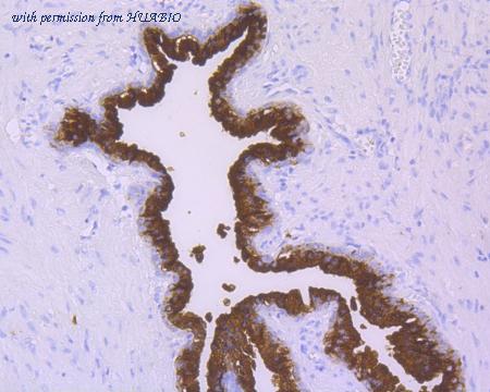 HUABIO ET7110-62 image 1