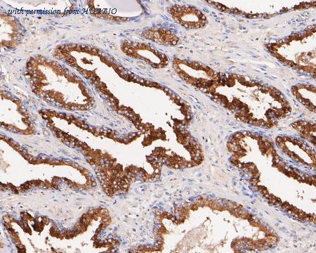 HUABIO ET7110-66 image 3