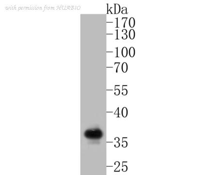 HUABIO ET7110-68 image 1