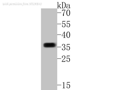 HUABIO ET7110-68 image 2