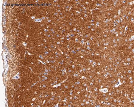 HUABIO ET7110-68 image 3