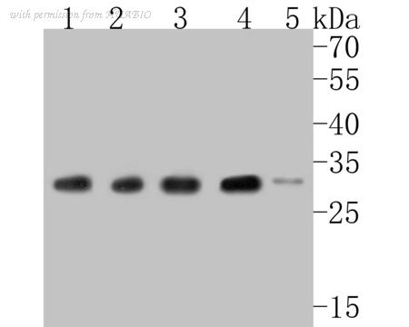 HUABIO ET7110-70 image 1