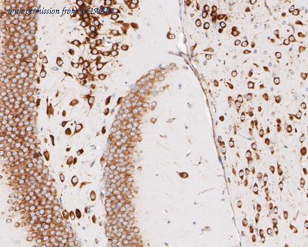 HUABIO ET7110-70 image 2