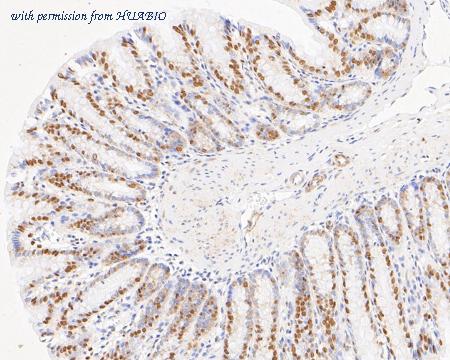 HUABIO ET7110-85 image 2