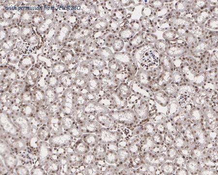 HUABIO ET7110-85 image 3