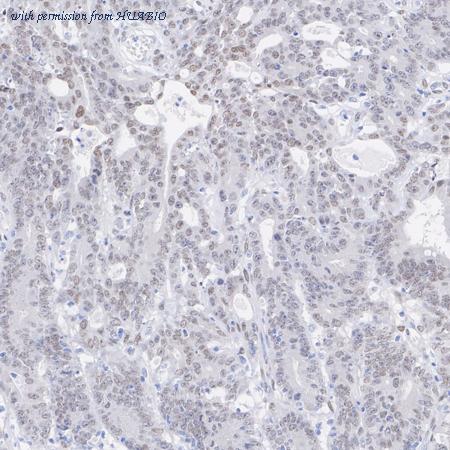 HUABIO ET7111-04 image 3