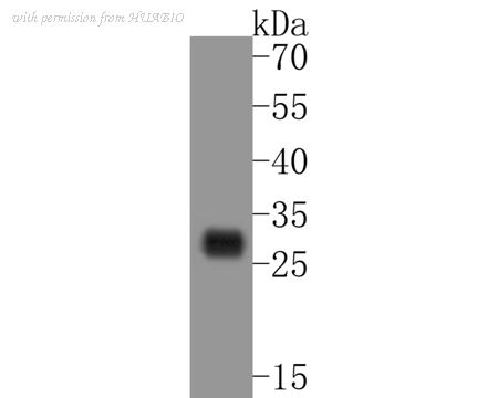HUABIO ET7111-17 image 1