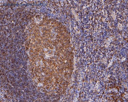 HUABIO ET7111-17 image 2