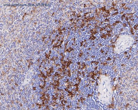 HUABIO ET7111-17 image 3