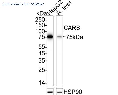 HUABIO ET7111-18 image 1