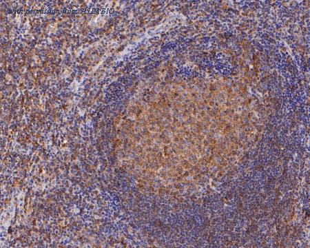 HUABIO ET7111-18 image 2