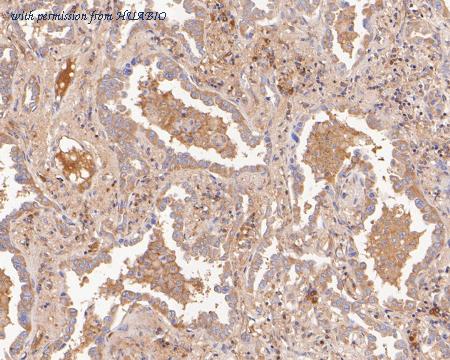 HUABIO ET7111-18 image 3