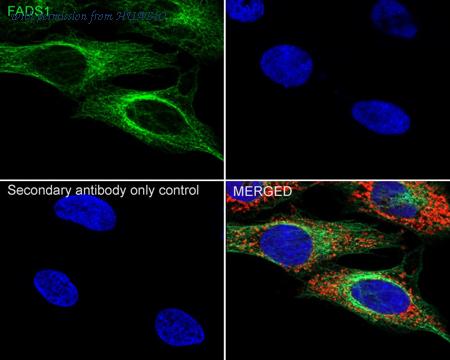 HUABIO ET7111-19 image 2