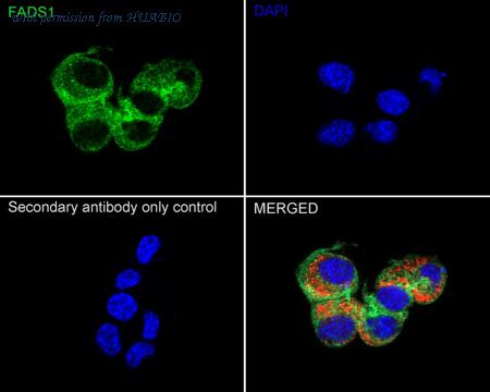 HUABIO ET7111-19 image 3