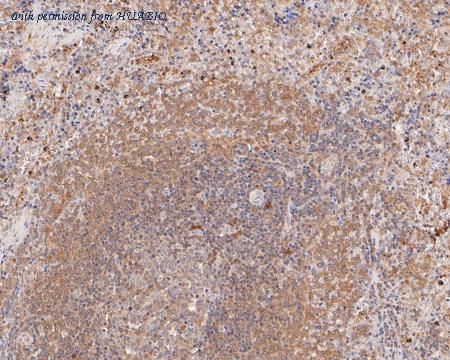 HUABIO ET7111-20 image 3