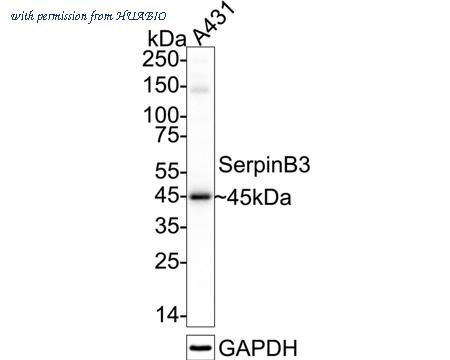HUABIO ET7111-21 image 1
