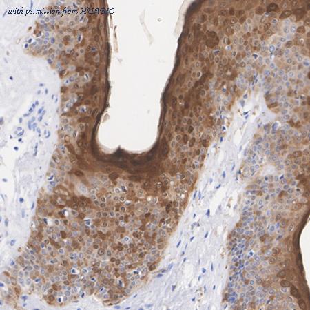 HUABIO ET7111-21 image 2