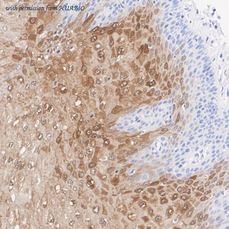 HUABIO ET7111-21 image 3