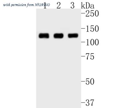 HUABIO ET7111-22 image 3
