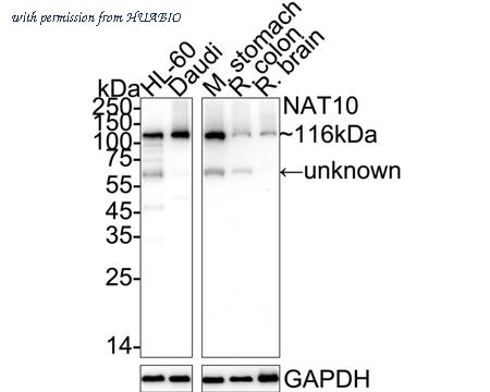 HUABIO ET7111-23 image 1
