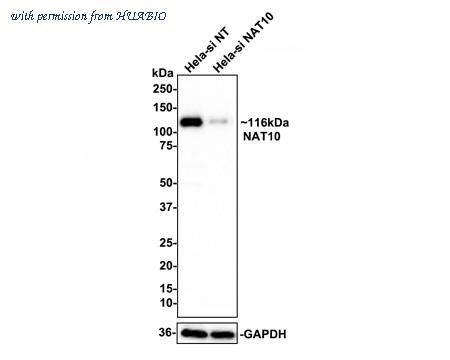 HUABIO ET7111-23 image 2