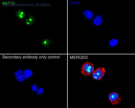 HUABIO ET7111-23 image 3