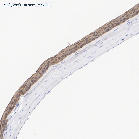 HUABIO ET7111-24 image 2