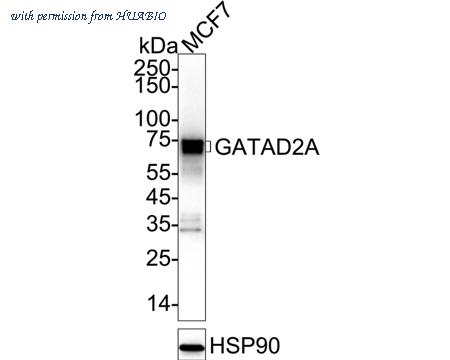 HUABIO ET7111-25 image 1
