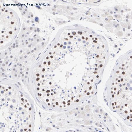 HUABIO ET7111-25 image 2