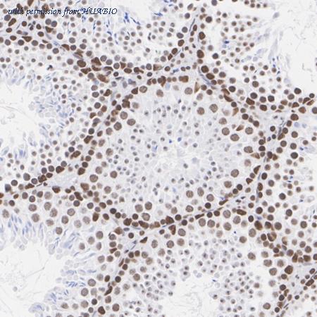 HUABIO ET7111-25 image 3