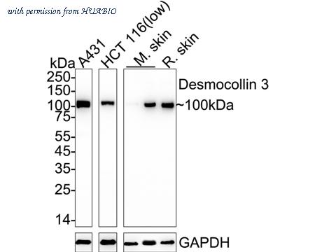 HUABIO ET7111-26 image 1