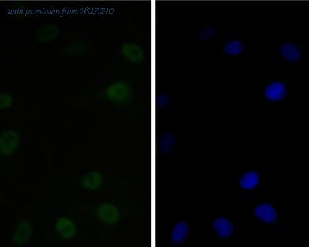 HUABIO ET7111-27 image 3