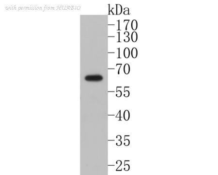 HUABIO ET7111-33 image 1