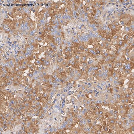 HUABIO ET7111-33 image 3