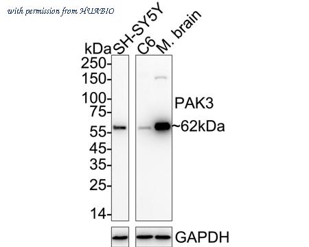 HUABIO ET7111-35 image 1