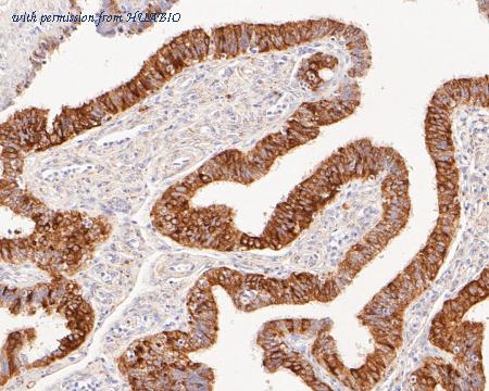 HUABIO ET7111-36 image 3