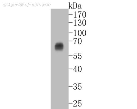 HUABIO ET7111-39 image 1