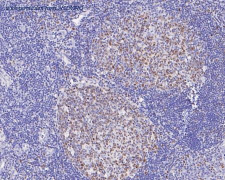 HUABIO ET7111-39 image 2