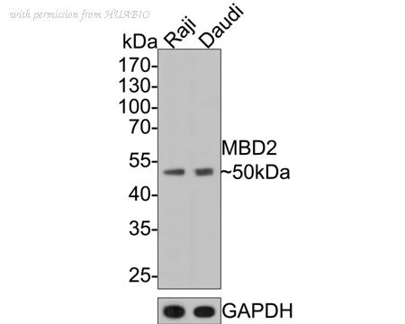 HUABIO ET7111-40 image 1