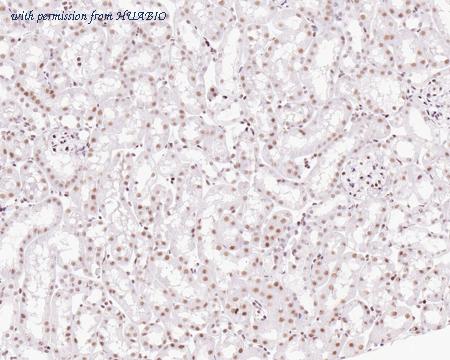 HUABIO ET7111-40 image 2