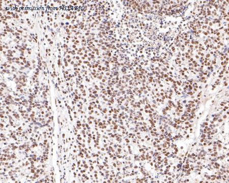 HUABIO ET7111-40 image 3