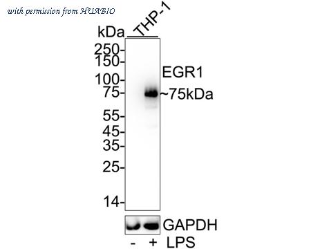 HUABIO ET7111-41 image 1