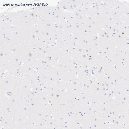 HUABIO ET7111-41 image 2