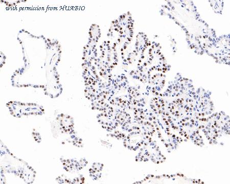 HUABIO ET7111-41 image 3