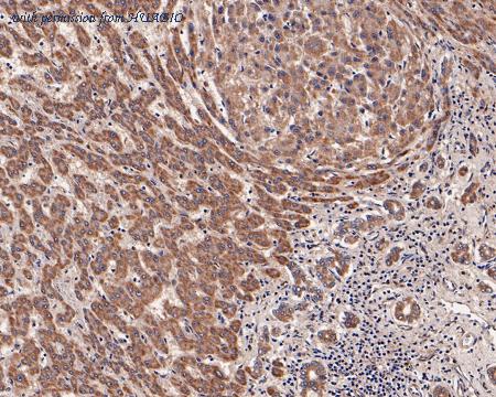 HUABIO HA500089 image 2