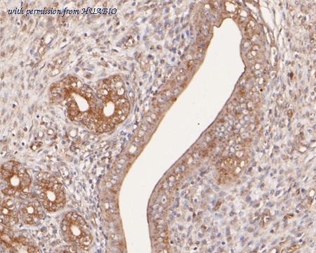 HUABIO HA500098 image 2